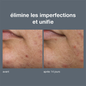 Deep breakout liquid patch