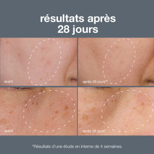 Powerbright dark spot system