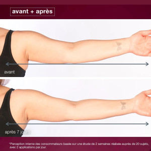 Dynamic skin sculptor