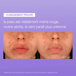 Stabilizing repair serum