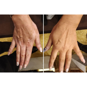 SprayFond Express 150ml