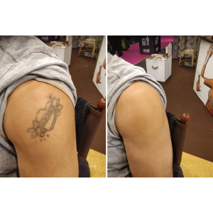 SprayFond Express 150ml